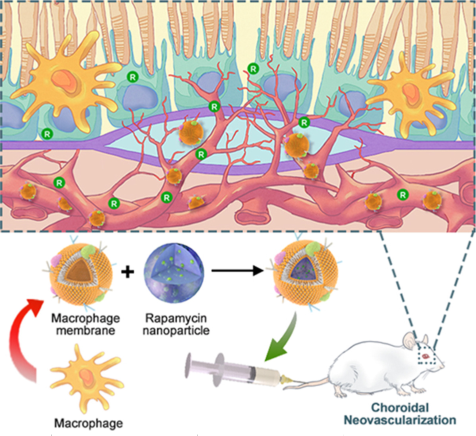 Intravenous route to choroidal neovascularization by macrophage-disguised nanocarriers for mTOR modulation_4