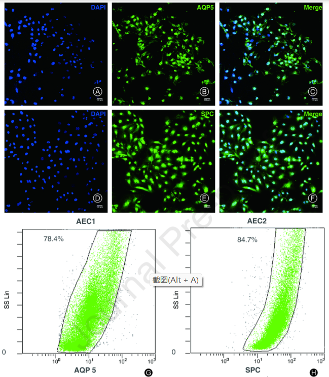 Continuous purification and culture of rat type 1 and type 2 alveolar epithelial cells by magnetic cell sorting_4