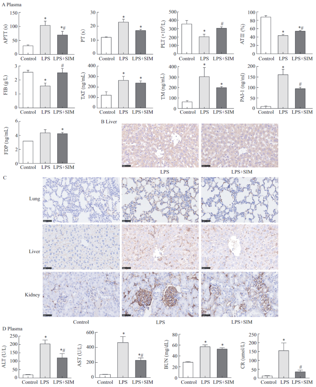 Simvastatin Improves Outcomes of Endotoxin-induced Coagulopathy by Regulating Intestinal Microenvironment_4