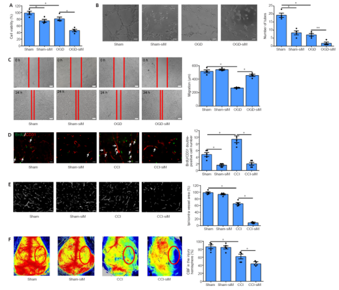 Essential role of MALAT1 in reducing traumatic brain injury_3