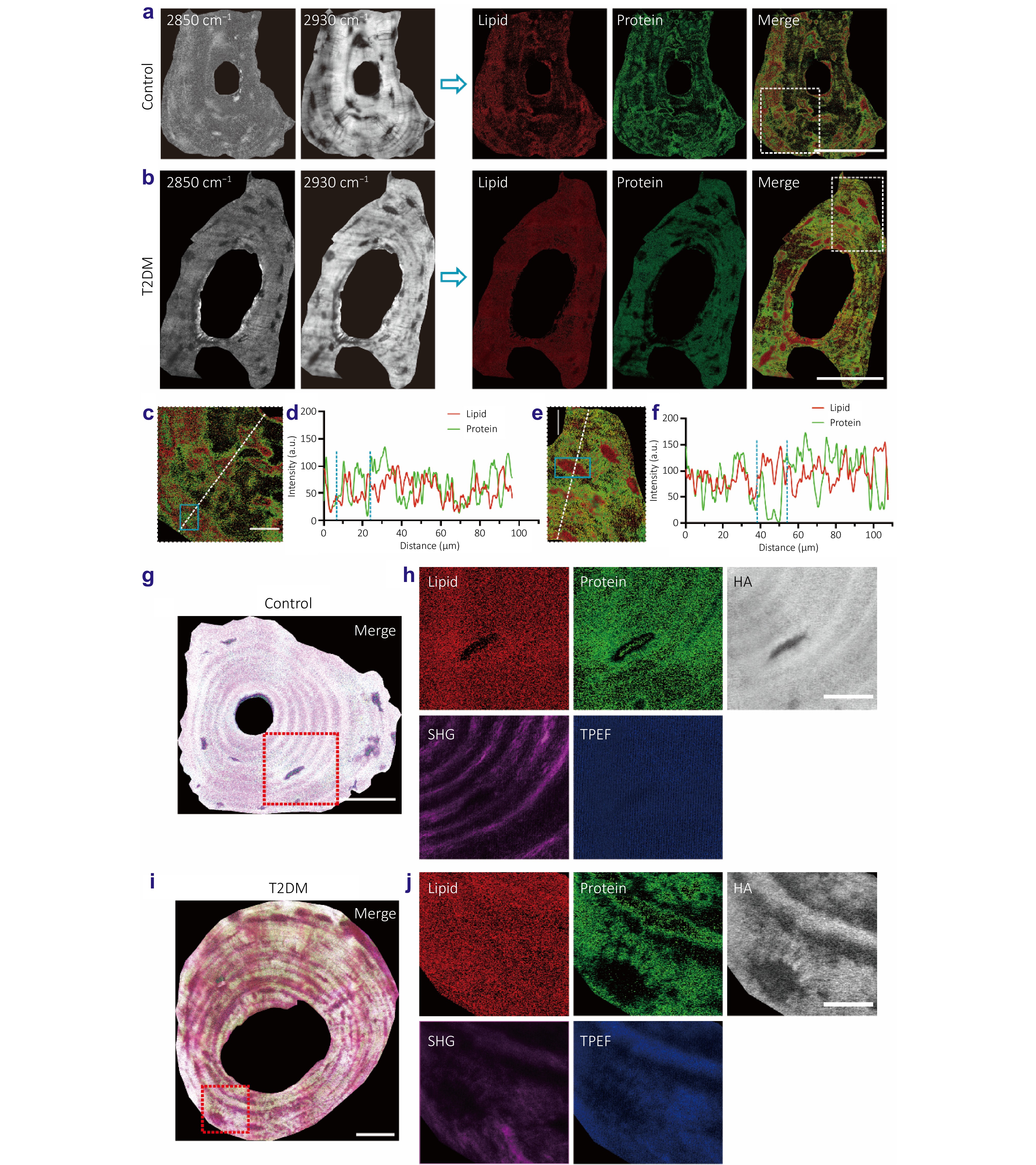 AI-powered nonlinear optical imaging reveals protein spatial homogenization as an indicator of impaired bone quality in type 2 diabetes_4