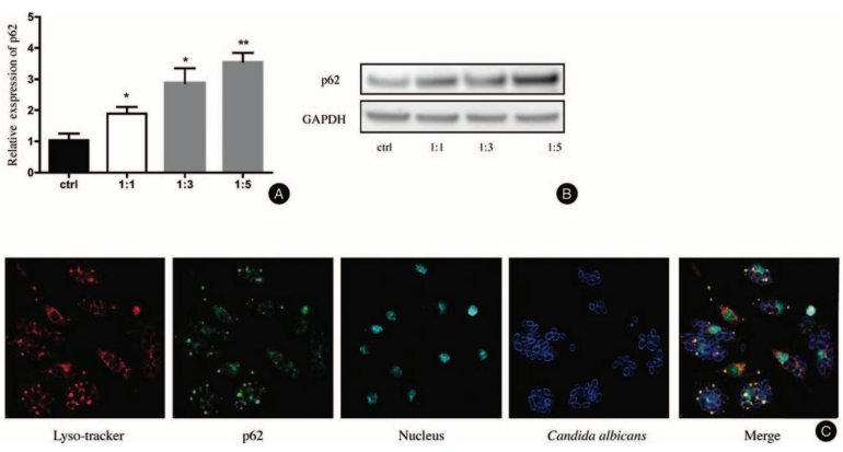 p62/SQSTM1 Participates in the Innate Immune Response of Macrophages Against Candida albicans Infection_5