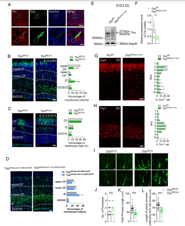 RhoGEF Trio Regulates Radial Migration of Projection Neurons via Its Distinct Domains_4